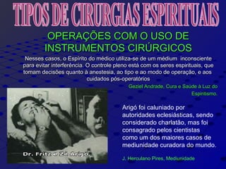 OPERAÇÕES COM O USO DEOPERAÇÕES COM O USO DE
INSTRUMENTOS CIRÚRGICOSINSTRUMENTOS CIRÚRGICOS
Nesses casos, o Espírito do médico utiliza-se de um médium inconscienteNesses casos, o Espírito do médico utiliza-se de um médium inconsciente
para evitar interferência. O controle pleno está com os seres espirituais, quepara evitar interferência. O controle pleno está com os seres espirituais, que
tomam decisões quanto à anestesia, ao tipo e ao modo de operação, e aostomam decisões quanto à anestesia, ao tipo e ao modo de operação, e aos
cuidados pós-operatórioscuidados pós-operatórios
Geziel Andrade, Cura e Saúde à Luz doGeziel Andrade, Cura e Saúde à Luz do
Espiritismo.Espiritismo.
Arigó foi caluniado por
autoridades eclesiásticas, sendo
considerado charlatão, mas foi
consagrado pelos cientistas
como um dos maiores casos de
mediunidade curadora do mundo.
J. Herculano Pires, Mediunidade
 