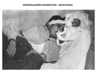MATERIALIZAÇÕES INCOMPLETAS – DEFEITUOSAS

 