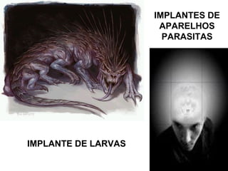 IMPLANTES DE
                      APARELHOS
                       PARASITAS




IMPLANTE DE LARVAS
 
