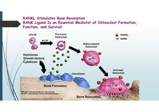 RANKL Stimulates Bone Resorption
RANK Ligand Is an Essential Mediator of Osteoclast Formation,
Function, and Survival
Osteoblasts
Activated
Osteoclast
CFU-M Pre-fusion
Osteoclast
Multinucleated
Osteoclast
Hormones
Growth factors
Cytokines
RANKL
RANK
Bone Formation
Bone Resorption
Adapted from Boyle WJ, et al. Nature. 2003;423:337-342.
M-CSF
CFU-M = colony forming unit macrophage
M-CSF = macrophage colony stimulating factor
 