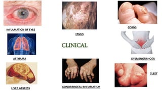 CLINICAL
INFLAMATION OF EYES
ASTHAMA
LIVER ABSCESS
FAVUS
GONORRHOEAL RHEUMATISM
CORNS
DYSMENORRHOEA
GLEET
 