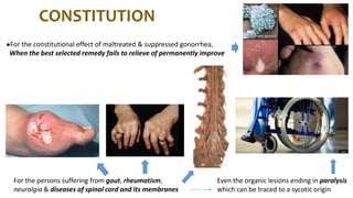 CONSTITUTION
●For the constitutional effect of maltreated & suppressed gonorrhea,
When the best selected remedy fails to relieve of permanently improve
For the persons suffering from gout, rheumatism,
neuralgia & diseases of spinal cord and its membranes
Even the organic lesions ending in paralysis
which can be traced to a sycotic origin
 