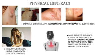 PHYSICAL GENERALS
● GREAT HEAT & SORENESS, WITH ENLARGEMENT OF LYMPHATIC GLANDS ALL OVER THE BODY.
● CONSUMPTIVE LANGUOR;
FATIGUE; GREAT GENERAL
DEPRESSION OF VITALITY
● PAINS: ARTHRITIC, RHEUMATIC,
A SEQUEL OF SUPRESSED GON-
ORRHOEA; CONSTRICTING, SEEM
TO TIGHTEN THE WHOLE BODY;
( CACT.) SORE ALL OVER, AS IF
BRUISHED ( ARN., EUP-per).
 
