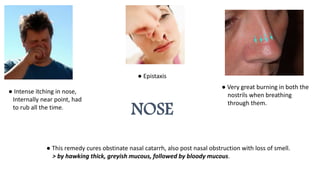 NOSE
● Intense itching in nose,
Internally near point, had
to rub all the time.
● Epistaxis
● Very great burning in both the
nostrils when breathing
through them.
● This remedy cures obstinate nasal catarrh, also post nasal obstruction with loss of smell.
> by hawking thick, greyish mucous, followed by bloody mucous.
 