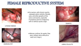 FEMALE REPRODUCTIVE SYSTEM
UTERINE FIBROID
OVARIAN CYST
OVARITIS
LABIAL CELLULITIS
● For women, with chronic ovaritis,
salpingitis pelvic cellulitis, fibroids,
cysts, and other growths of the
uterus and ovaries, especially
if symptoms point to malignancy
with or without sycotic origin.
● Menses: profuse, for weeks, flow
dark, clotted; stains difficult to
wash out ( mag-c).
 