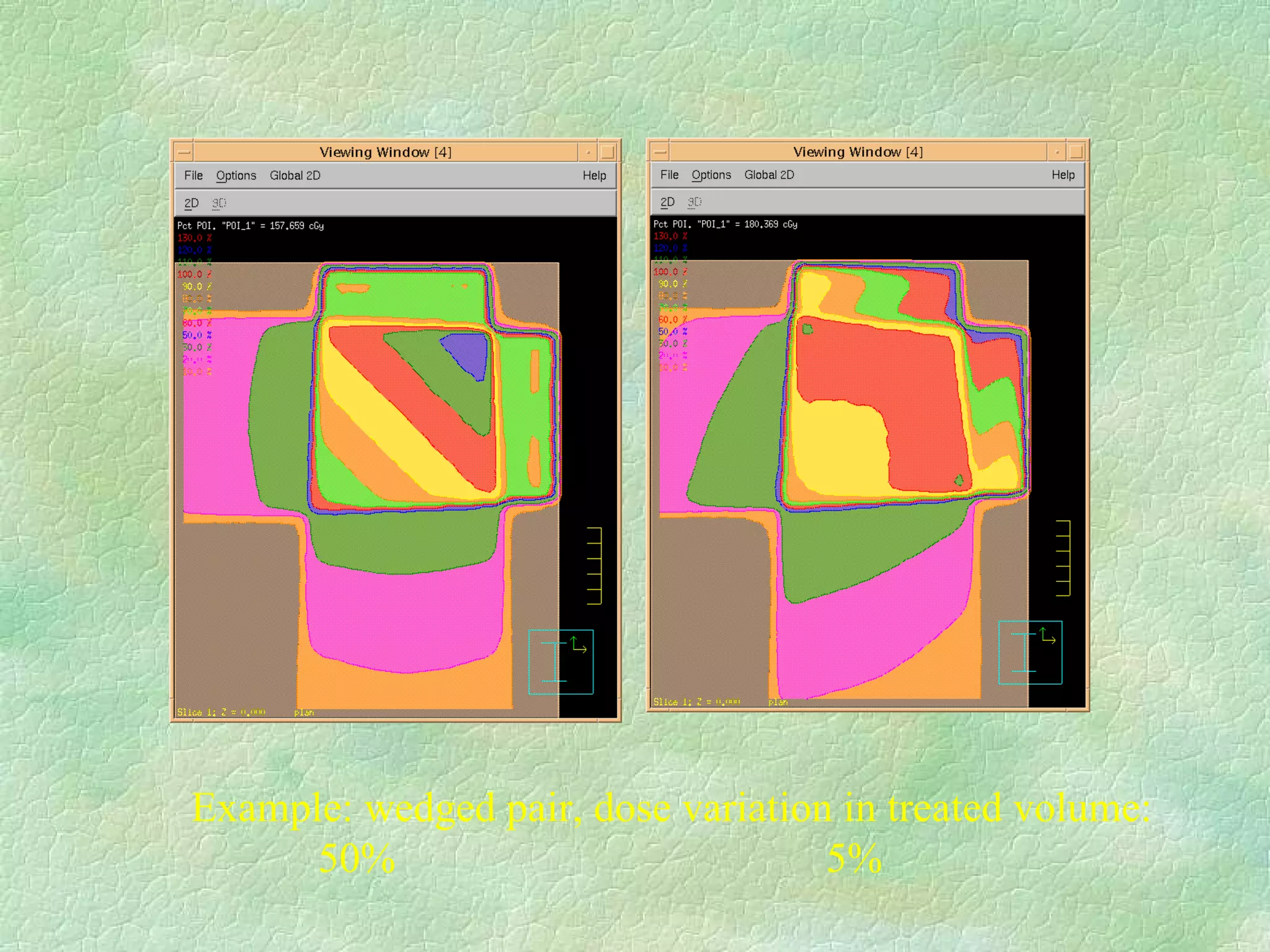 Example: wedged pair, dose variation in treated volume: 50% 5%  