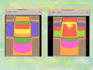 Use of wedges II:  To correct for beam attenuation when using multiple fields  Example: 3 field plan, variation in treated volume: 30% 5%  