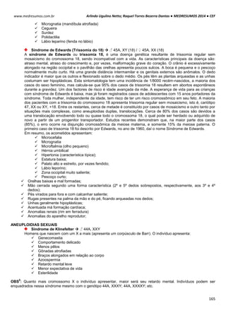 Arlindo Ugulino Netto; Raquel Torres Bezerra Dantas ● MEDRESUMOS 2014 ● CEF
165
www.medresumos.com.br
 Micrognatia (mandíbula atrofiada)
 Cegueira
 Surdez
 Polidactilia
 Lábio leparino (fenda no lábio)
Síndrome de Edwards (Trissomia do 18)  ♂ 45A, XY (18) / ♀ 45A, XX (18)
A síndrome de Edwards ou trissomia 18, é uma doença genética resultante de trissomia regular sem
mosaicismo do cromossoma 18, sendo incompatível com a vida. As características principais da doença são:
atraso mental, atraso do crescimento e, por vezes, malformação grave do coração. O crânio é excessivamente
alongado na região occipital e o pavilhão das orelhas apresenta poucos sulcos. A boca é pequena e o pescoço
normalmente muito curto. Há uma grande distância intermamilar e os genitais externos são anômalos. O dedo
indicador é maior que os outros e flexionado sobre o dedo médio. Os pés têm as plantas arqueadas e as unhas
costumam ser hipoplásticas. Esta sintomatologia tem uma incidência de 1/8000 recém-nascidos, a maioria dos
casos do sexo feminino, mas calcula-se que 95% dos casos de trissomia 18 resultem em abortos espontâneos
durante a gravidez. Um dos factores de risco é idade avançada da mãe. A esperança de vida para as crianças
com síndrome de Edwards é baixa, mas já foram registrados casos de adolescentes com 15 anos portadores da
síndrome. Toda mulher, independente da idade, tem risco de ter um risco cromossômico em seu feto. A maioria
dos pacientes com a trissomia do cromossomo 18 apresenta trissomia regular sem mosaicismo, isto é, cariótipo
47, XX ou XY, +18. Entre os restantes, cerca de metade é constituído por casos de mosaicismo e outro tanto por
situações mais complexas, como aneuploidias duplas, translocações. Cerca de 80% dos casos são devidos a
uma translocação envolvendo todo ou quase todo o cromossoma 18, o qual pode ser herdado ou adquirido de
novo a partir de um progenitor transportador. Estudos recentes demonstram que, na maior parte dos casos
(85%), o erro ocorre na disjunção cromossômica da meiose materna, e somente 15% da meiose paterna. O
primeiro caso de trissomia 18 foi descrito por Edwards, no ano de 1960, daí o nome Síndrome de Edwards.
Em resumo, os acometidos apresentam:
 Microcefalia
 Micrognatia
 Microftalmia (olho pequeno)
 Hérnia umbilical
 Hipertonia (característica típica);
 Estatura baixa;
 Palato alto e estreito, por vezes fendido;
 Lábio leporino;
 Zona occipital muito saliente;
 Pescoço curto;
 Orelhas baixas e mal formadas;
 Mão cerrada segundo uma forma característica (2º e 5º dedos sobrepostos, respectivamente, aos 3º e 4º
dedos);
 Pés virados para fora e com calcanhar saliente;
 Rugas presentes na palma da mão e do pé, ficando arqueadas nos dedos;
 Unhas geralmente hipoplásticas;
 Acentuada má formação cardíaca;
 Anomalias renais (rim em ferradura)
 Anomalias do aparelho reprodutor;
ANEUPLOIDIAS SEXUAIS
Síndrome de Klinefelter  ♂ 44A, XXY
Homens que nascem com um X a mais (apresenta um corpúsculo de Barr). O indivíduo apresenta:
 Genecomastia
 Comportamento delicado
 Menos pêlos
 Gônadas atrofiadas
 Braços alongados em relação ao corpo
 Azoospermia
 Retardo mental leve
 Menor expectativa de vida
 Esterilidade
OBS
8
: Quanto mais cromossomo X o indivíduo apresentar, maior será seu retardo mental. Indivíduos podem ser
enquadrados nessa síndrome mesmo com o genótipo 44A, XXXY; 44A, XXXXY; etc.
 