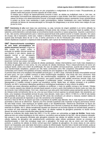 Arlindo Ugulino Netto ● MEDRESUMOS 2016 ● MAD II
189
www.medresumos.com.br
quer dizer que o portador apresenta um pior prognóstico e malignidade do tumor é maior. Provavelmente, já
existem nesta área grupos tumorais capazes de invadir vasos.
À medida que o tempo de desenvolvimento tumoral é maior, as células se multiplicam mais e, com isso, as
aberrações cromossômicas (alterações genéticas) aumentam a cada divisão. Este fator é importante pois, com o
passar do tempo e do desenvolvimento tumoral, a formação neoplásica passa a apresentar novas características
e podem se tornar mais resistentes à ação quimioterápica, realizar metástases com maior facilidade (maior
produção de fatores de neovascularização ou formação de colagenases) e se tornar ainda mais maligno do que
já era no início.
OBS
3
: Carcinoma in situ (com base nos carcinomas, ou seja, tumores de origem epitelial) é um termo utilizado na
patologia para indicar que a proliferação neoplásica formada ainda não rompeu a membrana basal do epitélio. Como
sabemos, profundamente a camada basal, já encontramos tecido conjuntivo e vasos sanguíneos. Quando o carcinoma é
in situ, não ocorreu extravasamento para o estroma (possível local onde poderia ocorrer a invasão vascular). Em casos
de cirurgia, não é necessário, neste caso, realizar a retirada de linfonodos, locais de possível disseminação neoplásica
quando esta formação deixa de ser in situ. O termo carcinoma in situ foi introduzido para indicar as lesões em que
células displásicas ocupavam a espessura total do epitélio, sem ruptura da membrana basal.
OBS
4
: Desenvolvimento cronológico
de uma lesão pré-neoplásica em
epiteio escamoso cervical. A figura ao
lado mostra, em quatro cortes, a
evolução do epitélio cervical escamoso
que recobre o colo uterino, desde um
aspecto normal a um pré-aspecto
neoplásico. Na primeira imagem
(Normal), podemos perceber o epitélio
escamoso normal que possui camadas
de células basais, logo após uma camada de células parabasais, células intermediárias (com muito mais citoplasma e
inclusões de glicogênio) e mais acima, há uma camada de células intersticiais. Para o desenvolvimento do tumor em
qualquer tecido, existe uma ordem de proliferação. No caso do epitélio cervical escamoso, quando ele começa a sofrer
uma transformação neoplásica, passará por três fases conhecidas como NIC (neoplasia intra-epitelial cervical, hoje
conhecidas como lesões intra-epiteliais cervicais), tratando de uma neoplasia in situ (intra-epitelial).
A primeira fase seria uma neoplasia intra-epitelial cervical grau I, ou NIC-I (hoje, chamada de lesão intra-epitelial cervical
de baixo grau), em que o epitélio começou a sofrer transformação neoplásica, mas ainda não virou carcinoma. Esta
lesão caracteriza, provavelmente, a maioria das transformações neoplásicas do epitélio cervical escamoso está
associada com o HPV (vírus do papiloma humano), que possui tropismo pelo epitélio escamoso cervical. Este vírus
promove alterações genéticas que vai desregular a proliferação celular, começando a ocorrer uma proliferação
desregulada e o epitélio começa a perder sua arquitetura normal. Nesta fase, as células começam a se proliferar.
Portanto, em NIC-I, acontecem alterações genéticas e morfológicas localizadas no terço inferior do epitélio
À medida que essas alterações genéticas e epiteliais se proliferam, o resto do epitélio começa a ser tomado. Células
com o mesmo aspecto das células da camada basal passam a tomar a parte intermediária do tecido (cada vez mais vão
se tornando mais indiferenciadas). Com isso, observa-se que esta parte intermediária passa apresentar grande número
de mitoses (onde normalmente não se via, uma vez que mitose é comum apenas na camada basal). Isto caracteriza, por
tanto, uma neoplasia intra-epitelial cervical de grau mais elevado, neste caso o NIC-II. O NIC-II e o NIC-III são lesões
intra-epiteliais de alto grau. Contudo, as fases do NIC ainda não constituem um câncer e, inclusive, existem relatos de
NIC-II que são passíveis de regressão (o que não caracteriza uma neoplasia).
Durante a fase do NIC-III, se espera que toda a arquitetura do epitélio seja alterada. Isto é, toda espessura do epitélio é
acometida e deixa de se diferenciar. Apenas uma fina camada superficial (não mostrada na figura) permanece normal.
Se esta lesão evoluir, toda espessura do epitélio passa a ser desdiferenciada. Observa-se claramente na figura (ao
comparar a figura intitulada como CIN III e a figura intitulada como Normal) a presença de células parabasais em toda a
extensão do epitélio, isto é, células semelhantes àquelas que deveriam se encontrar apenas na camada basal, passam a
se mostrar em toda extensão do epitélio. Além disso, as células repletas de glicogênio presentes no tecido normal
deixam de existir ao serem substituídas pelas células parabasais.
Quando as mulheres têm lesão deste tipo (NIC-I, II ou III), podem ser submetidas ao teste de Schiller. Neste teste,
aplica-se iodo em cortes histológicos do colo uterino e, se positivo para as lesões do tipo NIC, não se observa coloração.
Isto porque o iodo apresenta afinidade pelo glicogênio presente nas células do epitélio cervical. Contudo, como as
células repletas de glicogênio são gradativamente substituídas pelas células parabasais (devido ao processo de
desdiferenciação), o iodo não consegue reagir com o glicogênio. Os locais que não se coram com iodo refletem,
portanto, a ausência de células do tecido normal (que eram repletas de glicogênio). As zonas claras do colo uterino
devem ser biopsiadas, pois este teste demonstra a perda da diferenciação. Quando todo o tecido está tomado, pode-se
dizer que o carcinoma é in situ. Com a desdiferenciação, deixa-se de produzir ceratina (que é uma característica típica
do epitélio escamoso).
 
