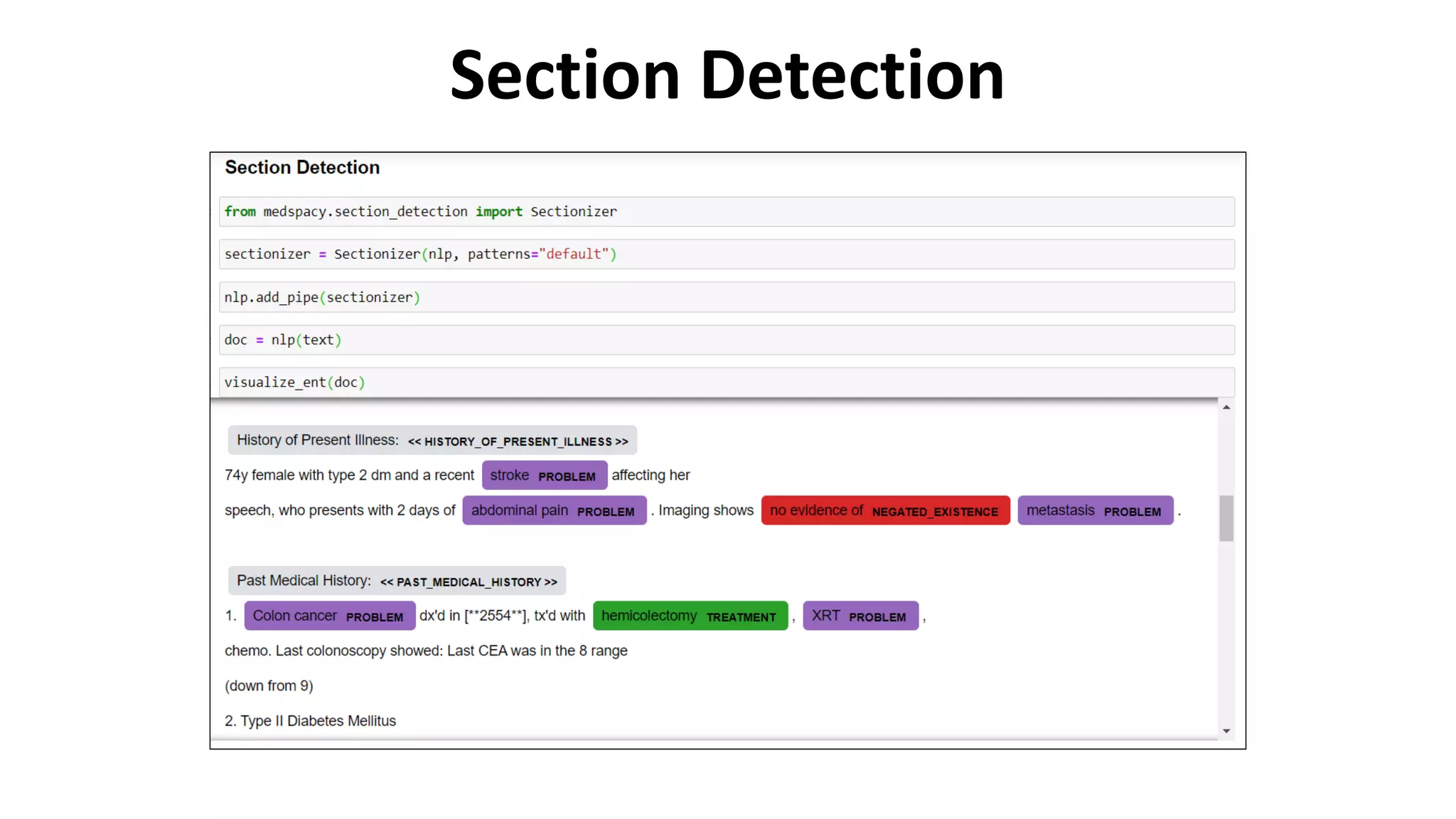 Section Detection
 