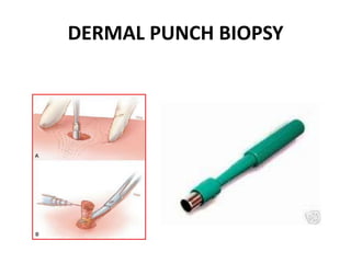 Punch Incision Derma Med surg endocrine & integumentary system | PPTX