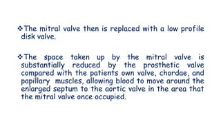 The mitral valve then is replaced with a low profile
disk valve.
The space taken up by the mitral valve is
substantially reduced by the prosthetic valve
compared with the patients own valve, chordae, and
papillary muscles, allowing blood to move around the
enlarged septum to the aortic valve in the area that
the mitral valve once occupied.
 