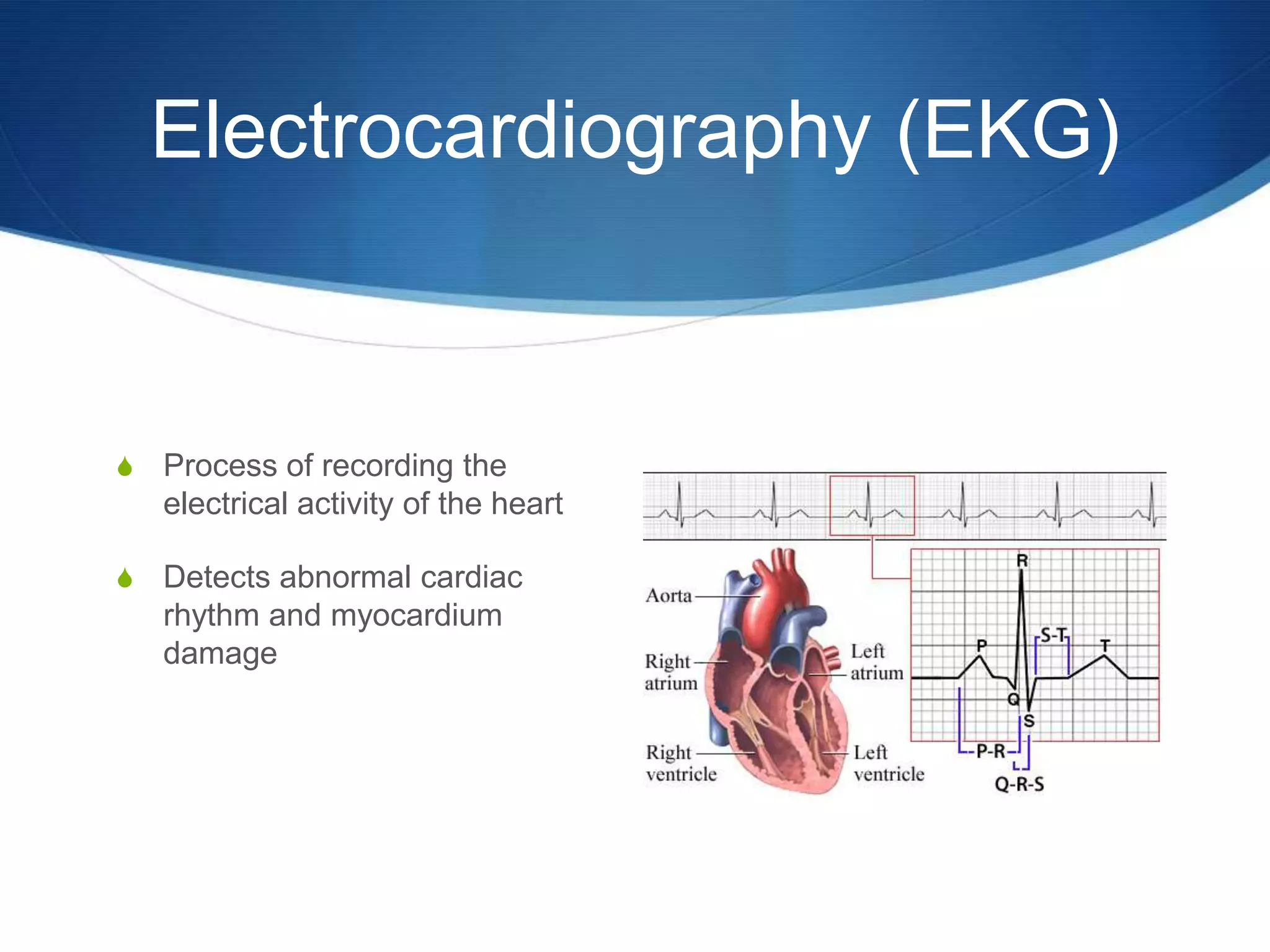 Electrocardiography (EKG)


S   Process of recording the
    electrical activity of the heart

S   Detects abnormal cardiac
    rhythm and myocardium
    damage
 