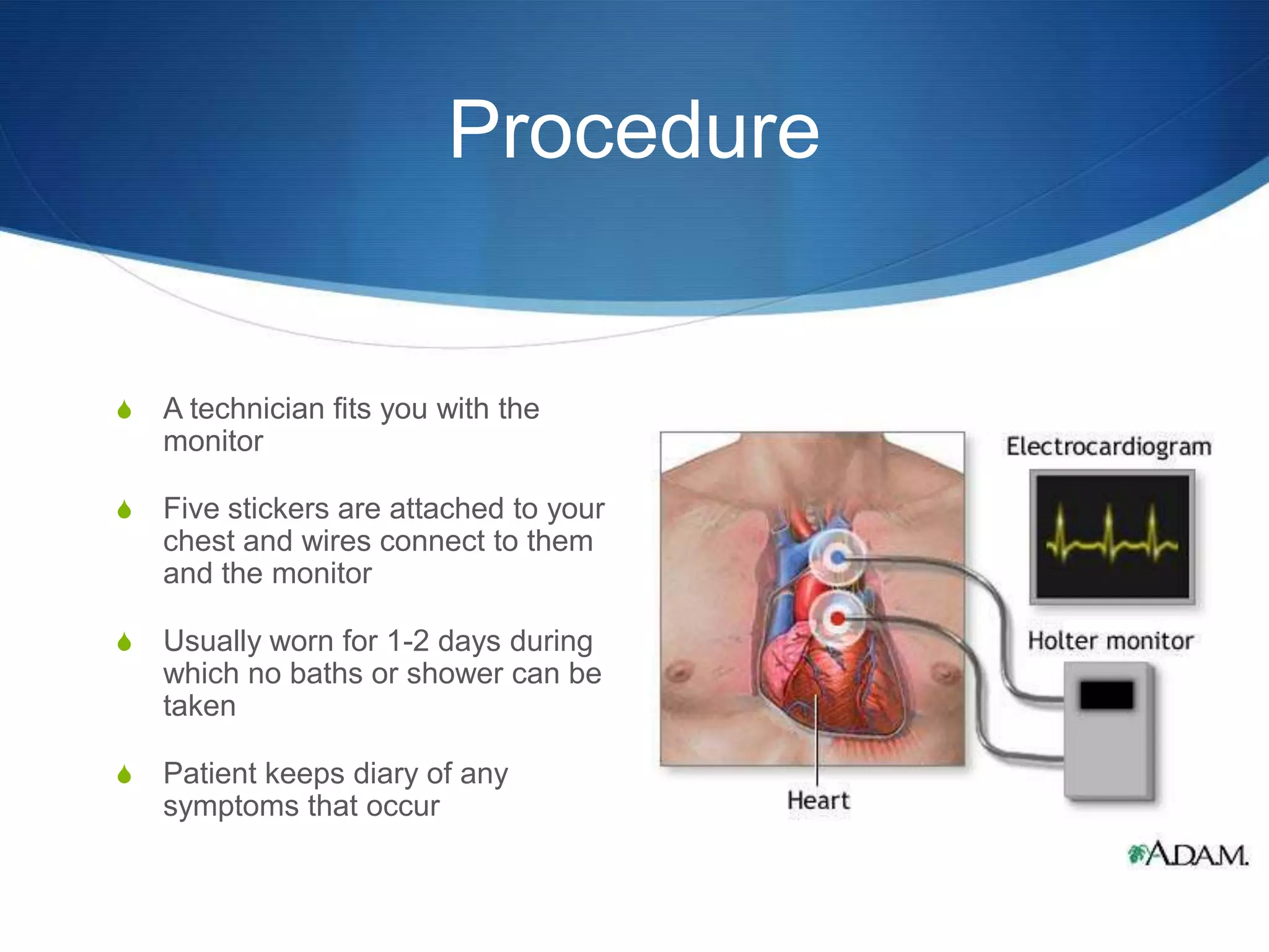 Procedure


S   A technician fits you with the
    monitor

S   Five stickers are attached to your
    chest and wires connect to them
    and the monitor

S   Usually worn for 1-2 days during
    which no baths or shower can be
    taken

S   Patient keeps diary of any
    symptoms that occur
 
