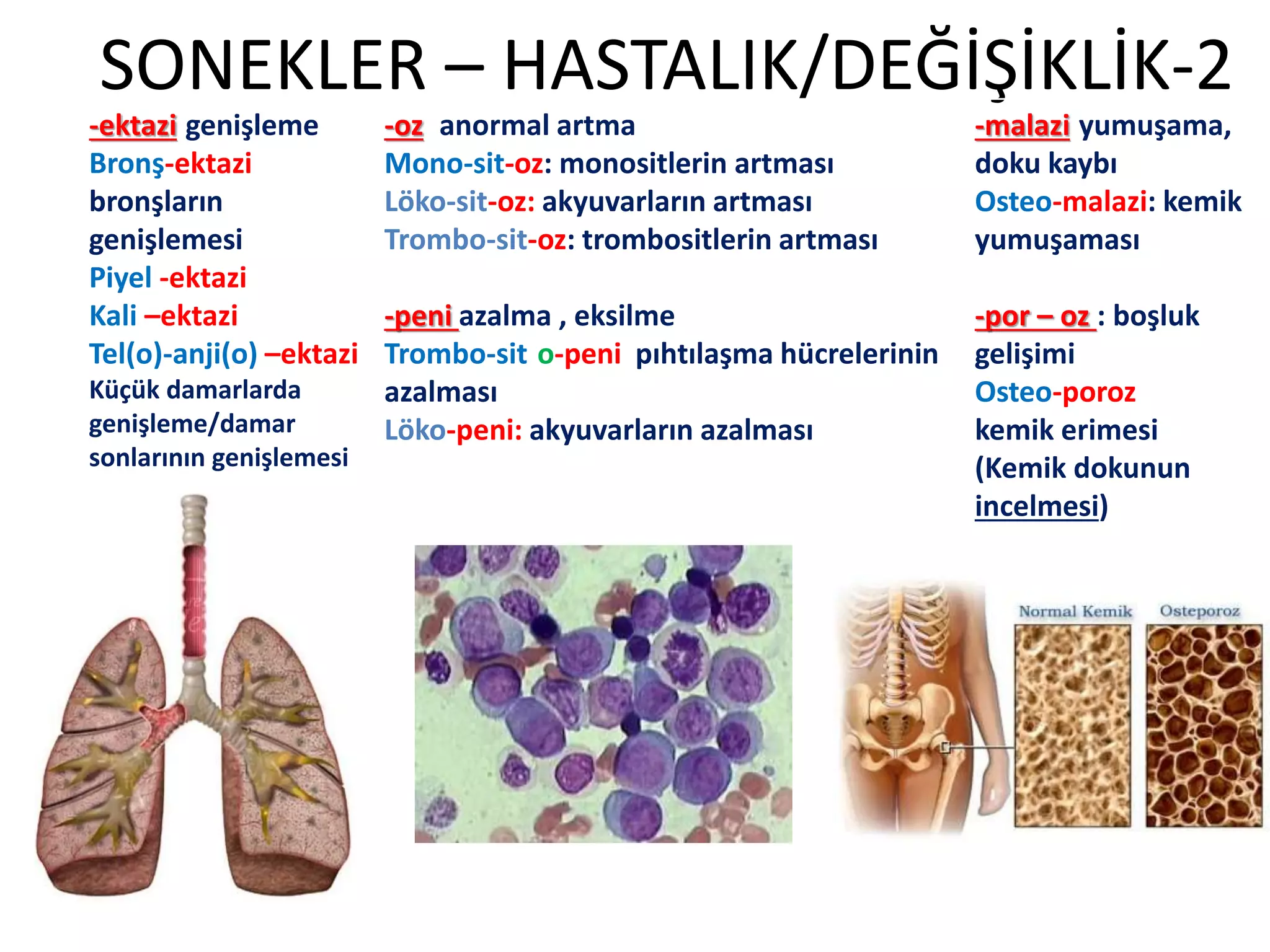 SONEKLER – HASTALIK/DEĞİŞİKLİK-2
-ektazi:genişleme
Bronş-ektazi
bronşların
genişlemesi
Piyel -ektazi
Kali –ektazi
Tel(o)-anji(o) –ektazi
Küçük damarlarda
genişleme/damar
sonlarının genişlemesi
-oz: anormal artma
Mono-sit-oz: monositlerin artması
Löko-sit-oz: akyuvarların artması
Trombo-sit-oz: trombositlerin artması
-peni azalma , eksilme
Trombo-sit-o-peni pıhtılaşma hücrelerinin
azalması
Löko-peni: akyuvarların azalması
-malazi:yumuşama,
doku kaybı
Osteo-malazi: kemik
yumuşaması
-por – oz : boşluk
gelişimi
Osteo-poroz:
kemik erimesi
(Kemik dokunun
incelmesi)
 