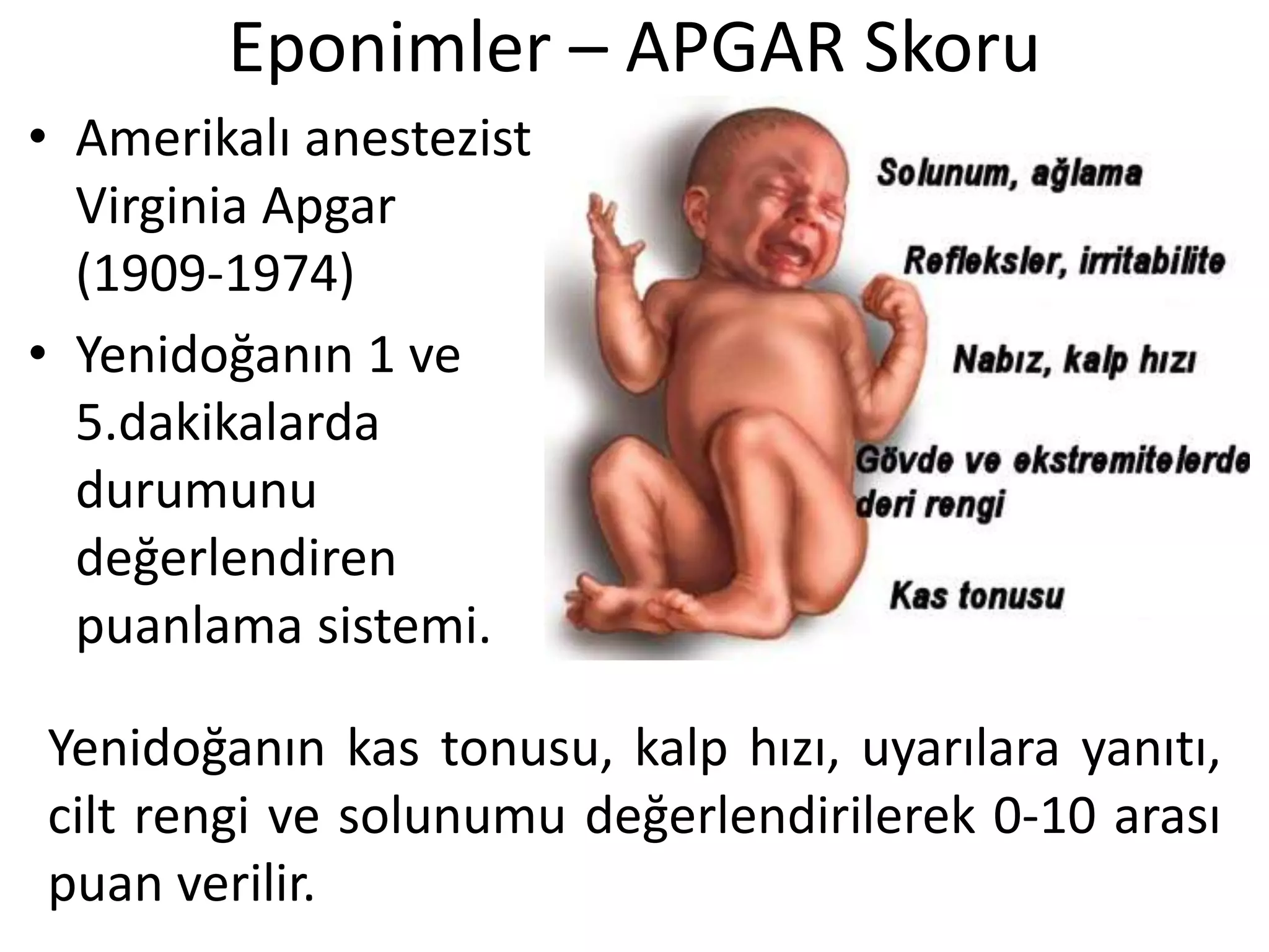 Eponimler – APGAR Skoru
• Amerikalı anestezist
Virginia Apgar
(1909-1974)
• Yenidoğanın 1 ve
5.dakikalarda
durumunu
değerlendiren
puanlama sistemi.
Yenidoğanın kas tonusu, kalp hızı, uyarılara yanıtı,
cilt rengi ve solunumu değerlendirilerek 0-10 arası
puan verilir.
 