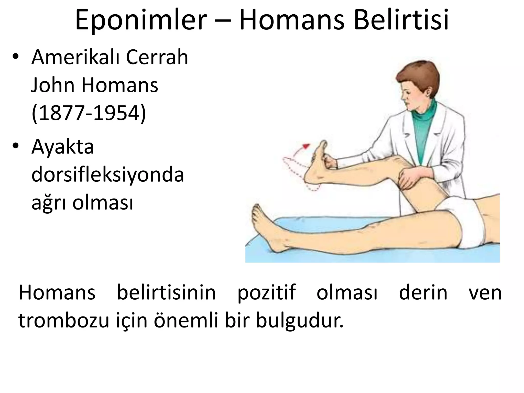 Eponimler – Homans Belirtisi
• Amerikalı Cerrah
John Homans
(1877-1954)
• Ayakta
dorsifleksiyonda
ağrı olması
Homans belirtisinin pozitif olması derin ven
trombozu için önemli bir bulgudur.
 
