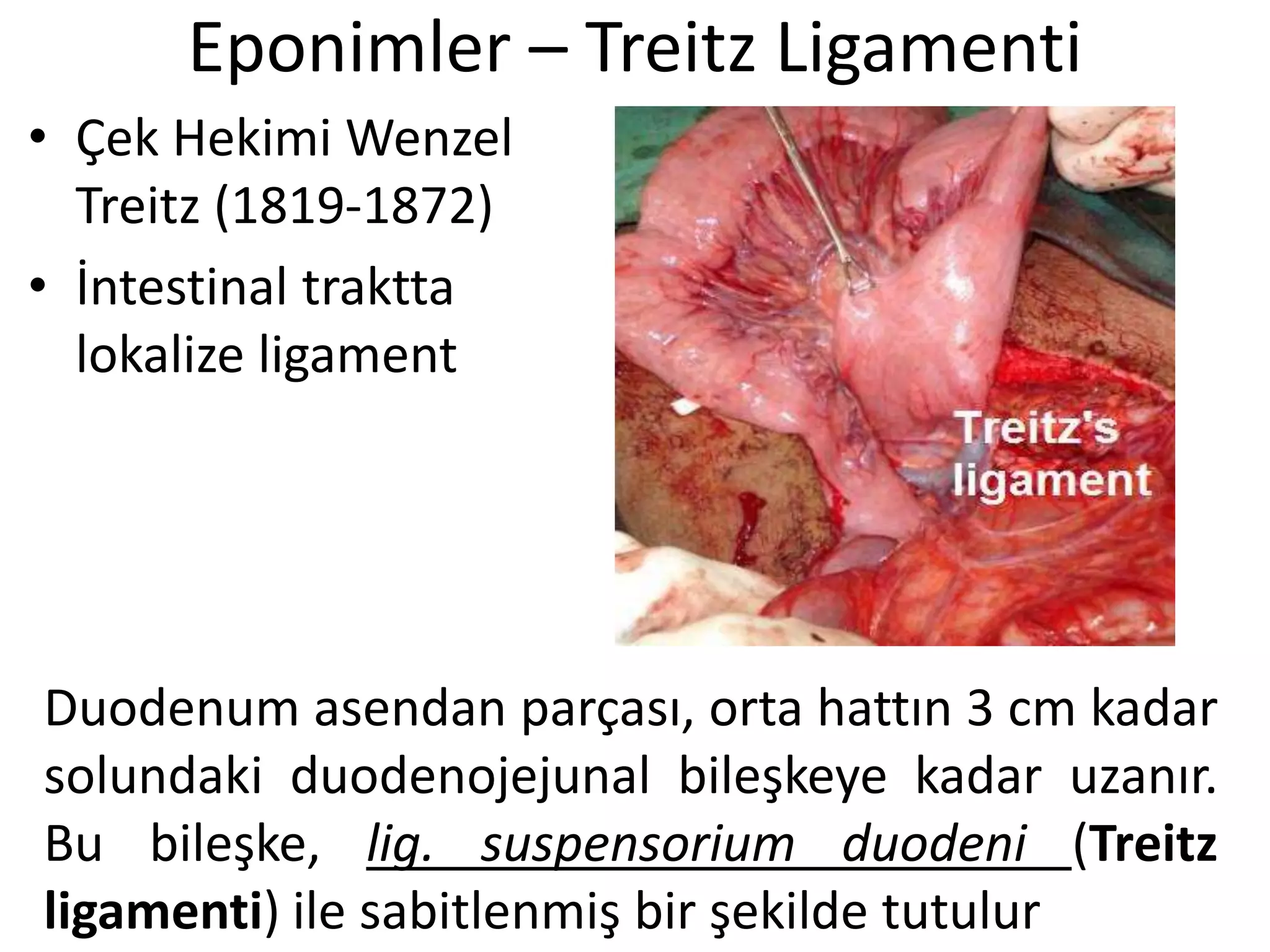 Eponimler – Treitz Ligamenti
• Çek Hekimi Wenzel
Treitz (1819-1872)
• İntestinal traktta
lokalize ligament
Duodenum asendan parçası, orta hattın 3 cm kadar
solundaki duodenojejunal bileşkeye kadar uzanır.
Bu bileşke, lig. suspensorium duodeni (Treitz
ligamenti) ile sabitlenmiş bir şekilde tutulur
 