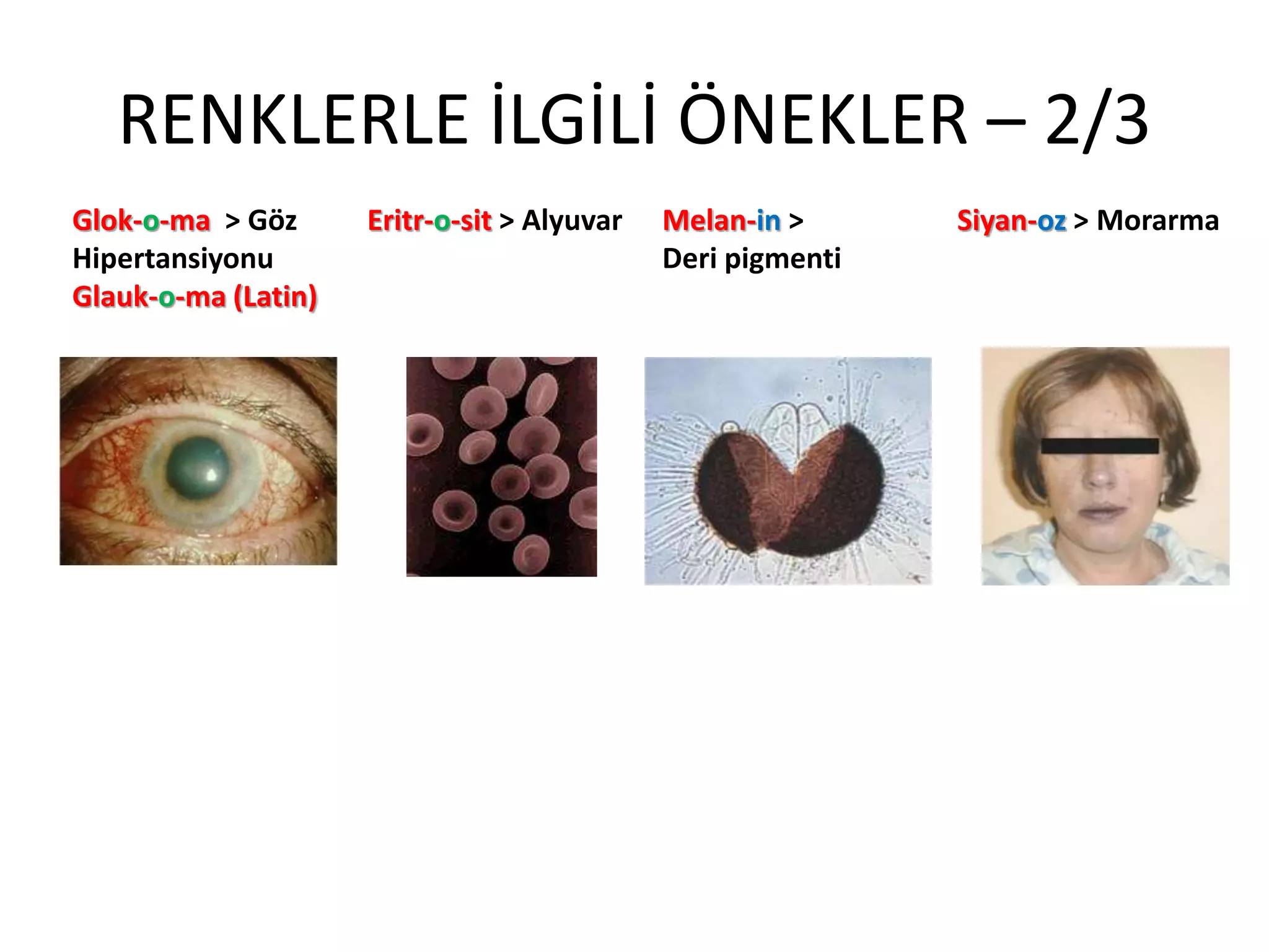 RENKLERLE İLGİLİ ÖNEKLER – 2/3
Glok-o-ma > Göz
Hipertansiyonu
Glauk-o-ma (Latin)
Eritr-o-sit > Alyuvar Melan-in >
Deri pigmenti
Siyan-oz > Morarma
 