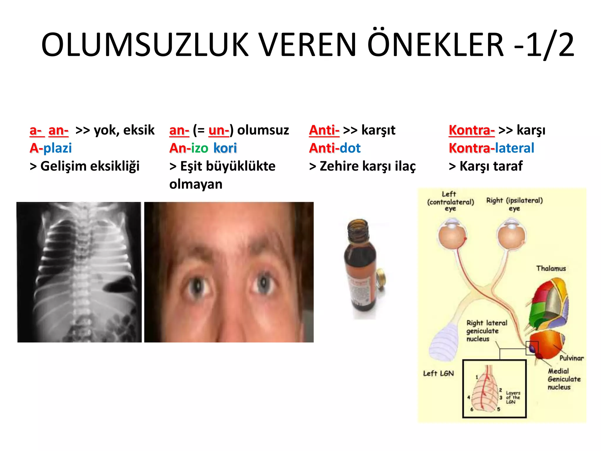 OLUMSUZLUK VEREN ÖNEKLER -1/2
a- an- >> yok, eksik
A-plazi
> Gelişim eksikliği
an- (= un-) olumsuz
An-izo-kori
> Eşit büyüklükte
olmayan
Anti- >> karşıt
Anti-dot
> Zehire karşı ilaç
Kontra- >> karşı
Kontra-lateral
> Karşı taraf
 