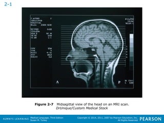 Figure 2-7 Midsagittal view of the head on an MRI scan. 
Medical Language, Third Edition 
Susan M. Turley 
Copyright © 2014, 2011, 2007 by Pearson Education, Inc. 
All Rights Reserved 
DrUnique/Custom Medical Stock 
2-1 
 
