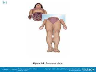 Medical Language, Third Edition 
Susan M. Turley 
Copyright © 2014, 2011, 2007 by Pearson Education, Inc. 
All Rights Reserved 
Figure 2-9 Transverse plane. 
2-1 
 