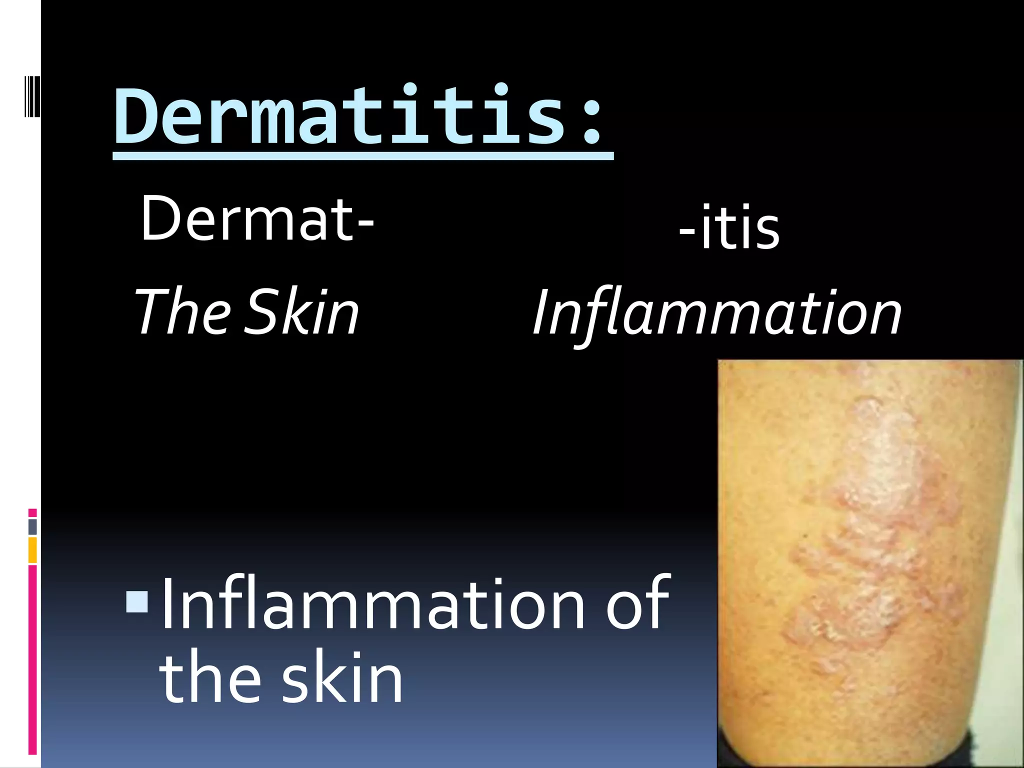 Dermat--itisInflammation of the skinThe SkinInflammationDermatitis: