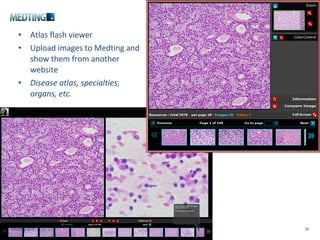 Atlas viewer Atlas flash viewer Upload images to Medting and show them from another website Disease atlas, specialties, organs, etc. Medting.com 
