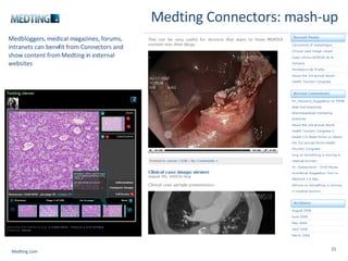 Medting Connectors: mash-up Medbloggers, medical magazines, forums, intranets can benefit from Connectors and show content from Medting in external websites Medting.com 