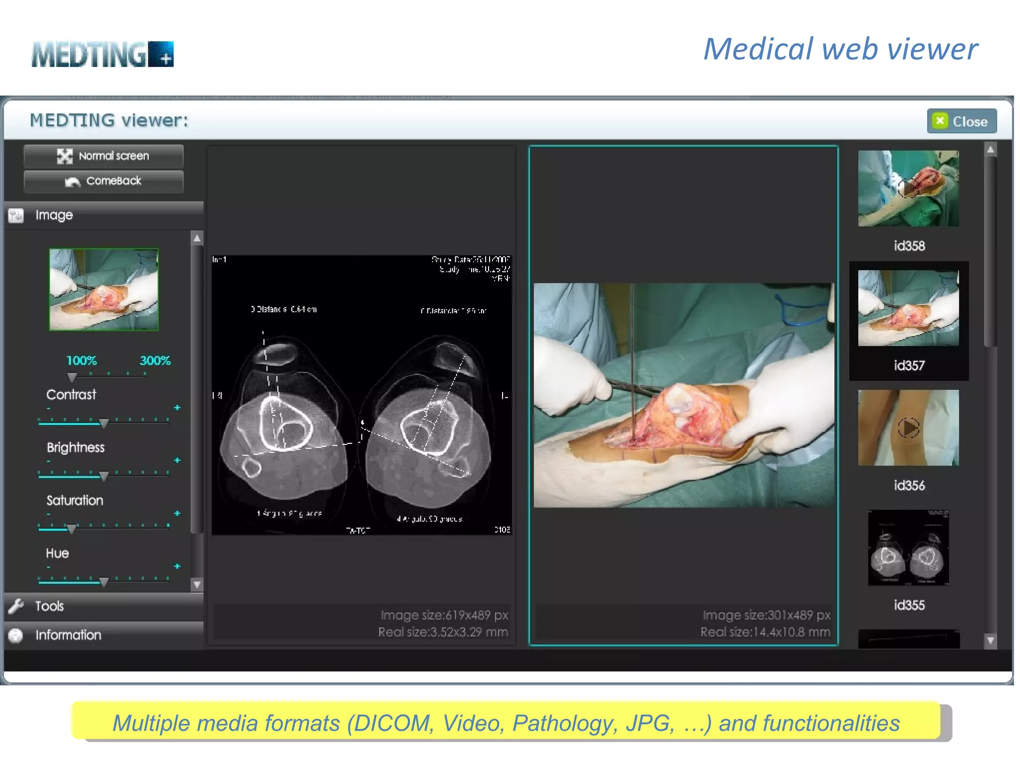 Medical web viewer Multiple media formats (DICOM, Video, Pathology, JPG, …) and functionalities 