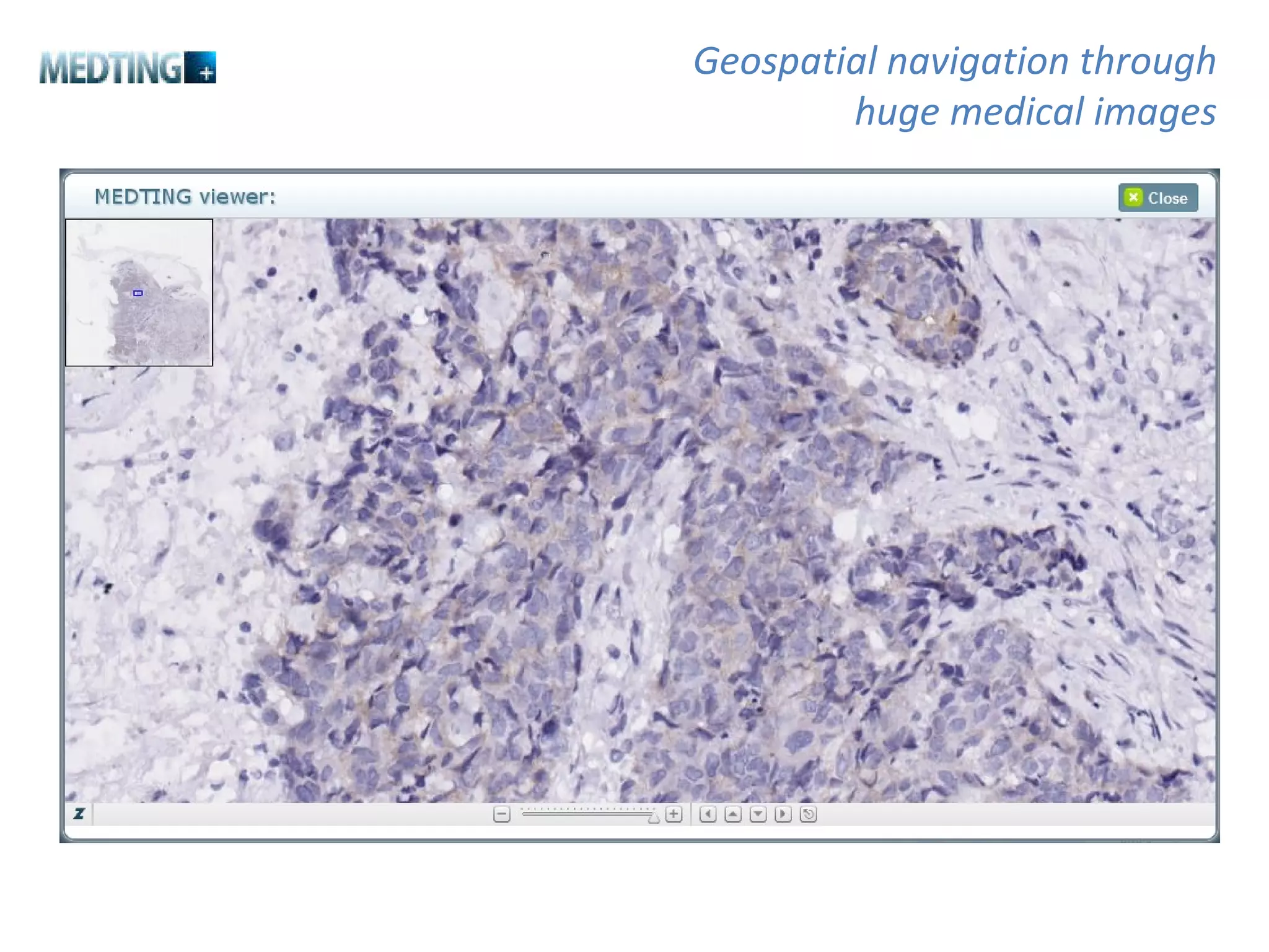 Geospatial navigation through huge medical images 