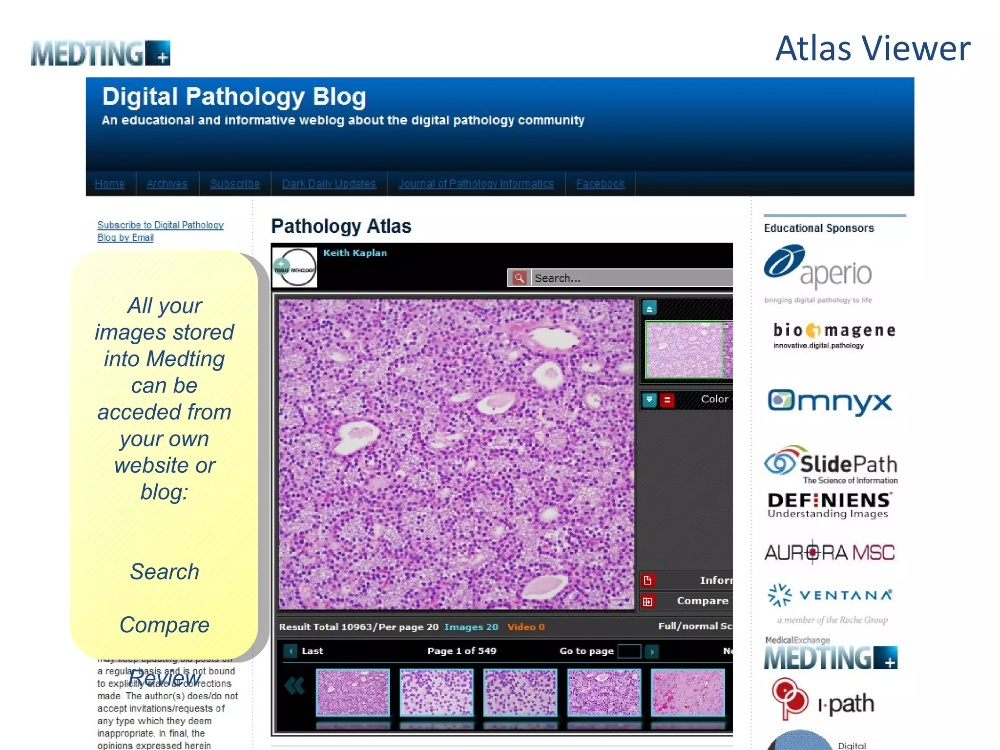 Atlas Viewer All your images stored into Medting can be acceded from your own website or blog: Search Compare Review 