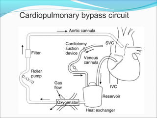   Cardiopulmonary bypass circuit 
 
 