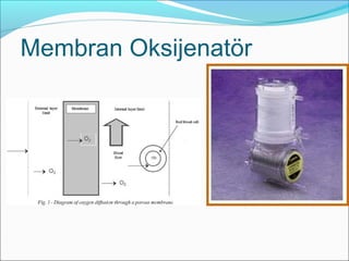 Membran Oksijenatör
 Carmeda® AFFINITY® NT Oxygenator
 