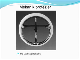  The Medtronic Hall valve
Mekanik protezler
 