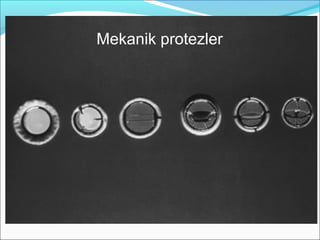 Mekanik protezler
 