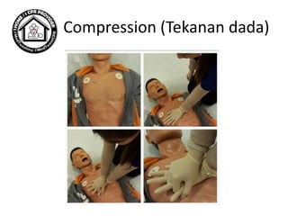 Compression (Tekanan dada)
 