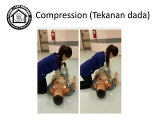 Compression (Tekanan dada)
 