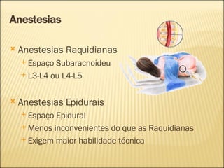 Anestesias Anestesias Raquidianas Espaço Subaracnoideu L3-L4 ou L4-L5 Anestesias Epidurais Espaço Epidural Menos inconvenientes do que as Raquidianas Exigem maior habilidade técnica 