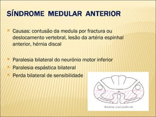 Causas: contusão da medula por fractura ou deslocamento vertebral, lesão da artéria espinhal anterior, hérnia discal Paralesia bilateral do neurónio motor inferior Paralesia espástica bilateral Perda bilateral de sensibilidade 