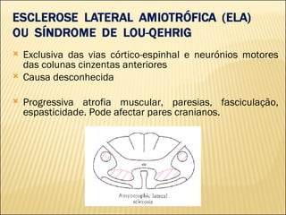 Exclusiva das vias córtico-espinhal e neurónios motores das colunas cinzentas anteriores Causa desconhecida Progressiva atrofia muscular, paresias, fasciculação, espasticidade. Pode afectar pares cranianos. 