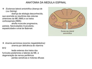 ANATOMIA DA MEDULA ESPINAL
 Esclerose lateral amiotrófica (doença de
Lou Gehrig):
doença de etiologia desconhecida,
que acomete os neurônios das colunas
anteriores da ME (NMI) e os tratos
corticospinais (NMS)
atrofia muscular progressiva,
paresia, fasciculações musculares,
espasticidade e sinal de Babinski
 Anemia perniciosa (anemia megaloblástica):
anemia por deficiência de vitamina
B12
lesão extensa dos tratos dos
funículos posteriores e laterais da ME, e
degeneração de nervos periféricos
perdas sensitivas e motoras difusas
 