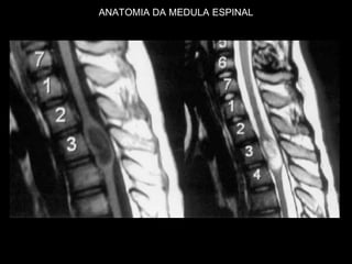 ANATOMIA DA MEDULA ESPINAL
 