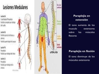 Paraplejia en
extensión
El tono aumenta de los
musculo extensores
sobre los músculos
flexores
Paraplejia en flexión
El tono disminuye de los
músculos extensores
 