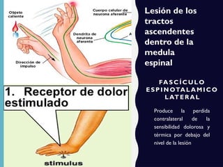 FASC Í C UL O
ESP I N OTAL AMI CO
LATER AL
Produce la perdida
contralateral de la
sensibilidad dolorosa y
térmica por debajo del
nivel de la lesión
Lesión de los
tractos
ascendentes
dentro de la
medula
espinal
 