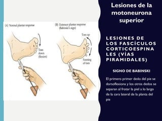 LE SI ON ES D E
LO S FASC Í C UL OS
C ORT I C OES PI NA
LE S (VÍ AS
P I R AMI DAL ES)
SIGNO DE BABINSKI
El primero primer dedo del pie se
dorsoflexiona y los otros dedos se
separan al frotar la piel a lo largo
de la cara lateral de la planta del
pie
Lesiones de la
motoneurona
superior
 