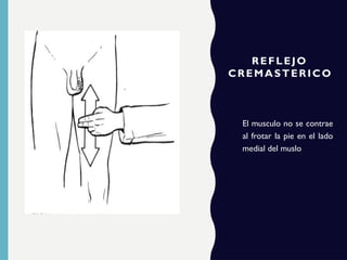 REFLEJO
CREMASTERICO
El musculo no se contrae
al frotar la pie en el lado
medial del muslo
 