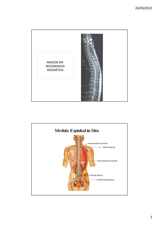 26/03/2012




IMAGEM EM
RESSONANCIA
 MAGNÉTICA




              Intumescência cervical
                                Plexo braquial




                         Intumescência lombar




                 Cauda equina

                         Plexo lombosacral




                                                         2
 