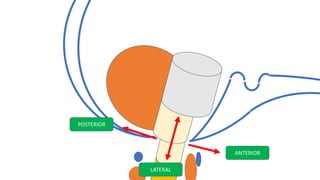 ANTERIOR
POSTERIOR
LATERAL
 