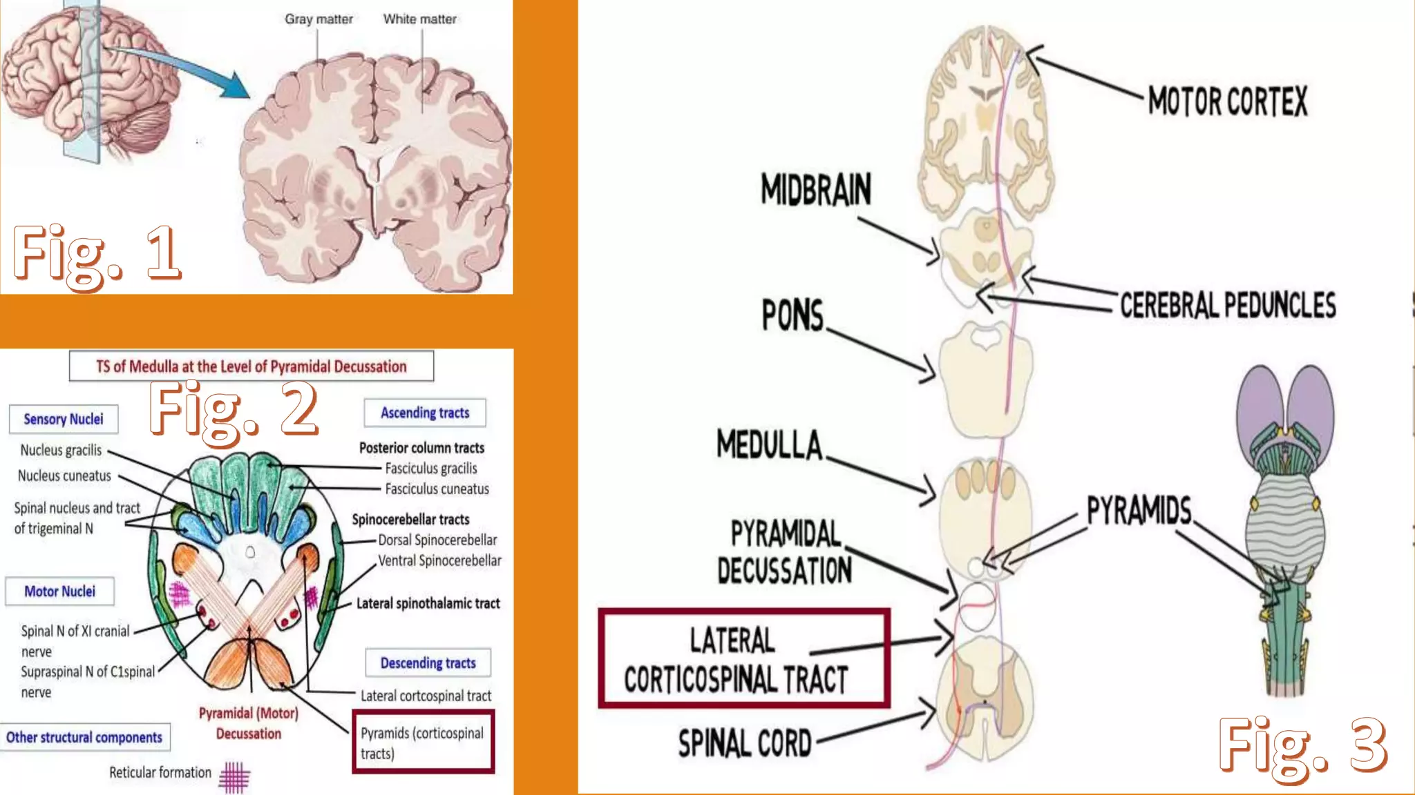 Medulla Oblongata | PPTX